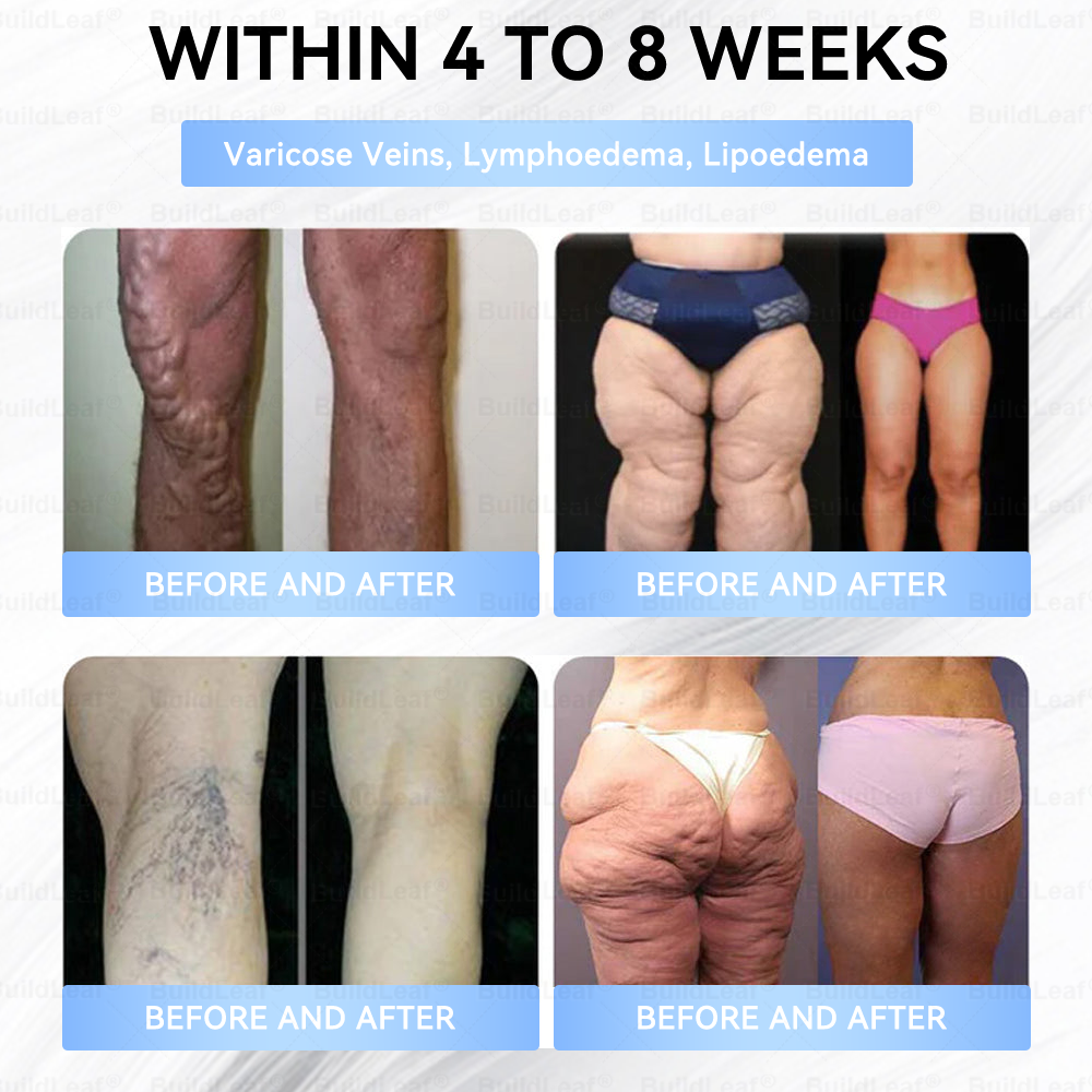 🏥𝑶𝒇𝒇𝒊𝒄𝒊𝒂𝒍 𝑺𝒕𝒐𝒓𝒆 |𝐵uil𝗱𝐿ea𝐟® 𝑮𝐋𝑃-1 Slim & Firm 𝑁ano 𝑀icroneedle 𝑃atch with Collagen,Turmeric&Matrixyl 3000 丨Obesity,Cardiovascular Diseas, Diabetes, Sleep Apnea, Joint Problems and More