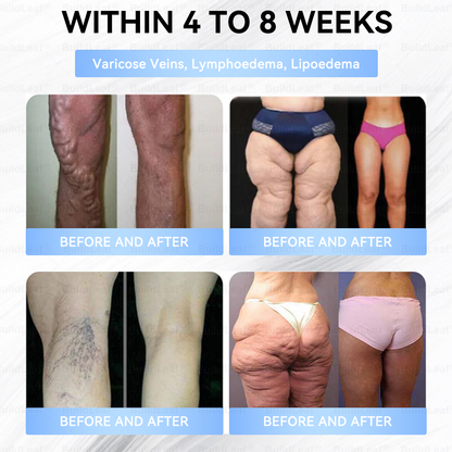 🏥𝑶𝒇𝒇𝒊𝒄𝒊𝒂𝒍 𝑺𝒕𝒐𝒓𝒆 |𝐵uil𝗱𝐿ea𝐟® 𝑮𝐋𝑃-1 Slim & Firm 𝑁ano 𝑀icroneedle 𝑃atch with Collagen,Turmeric&Matrixyl 3000 丨Obesity,Cardiovascular Diseas, Diabetes, Sleep Apnea, Joint Problems and More