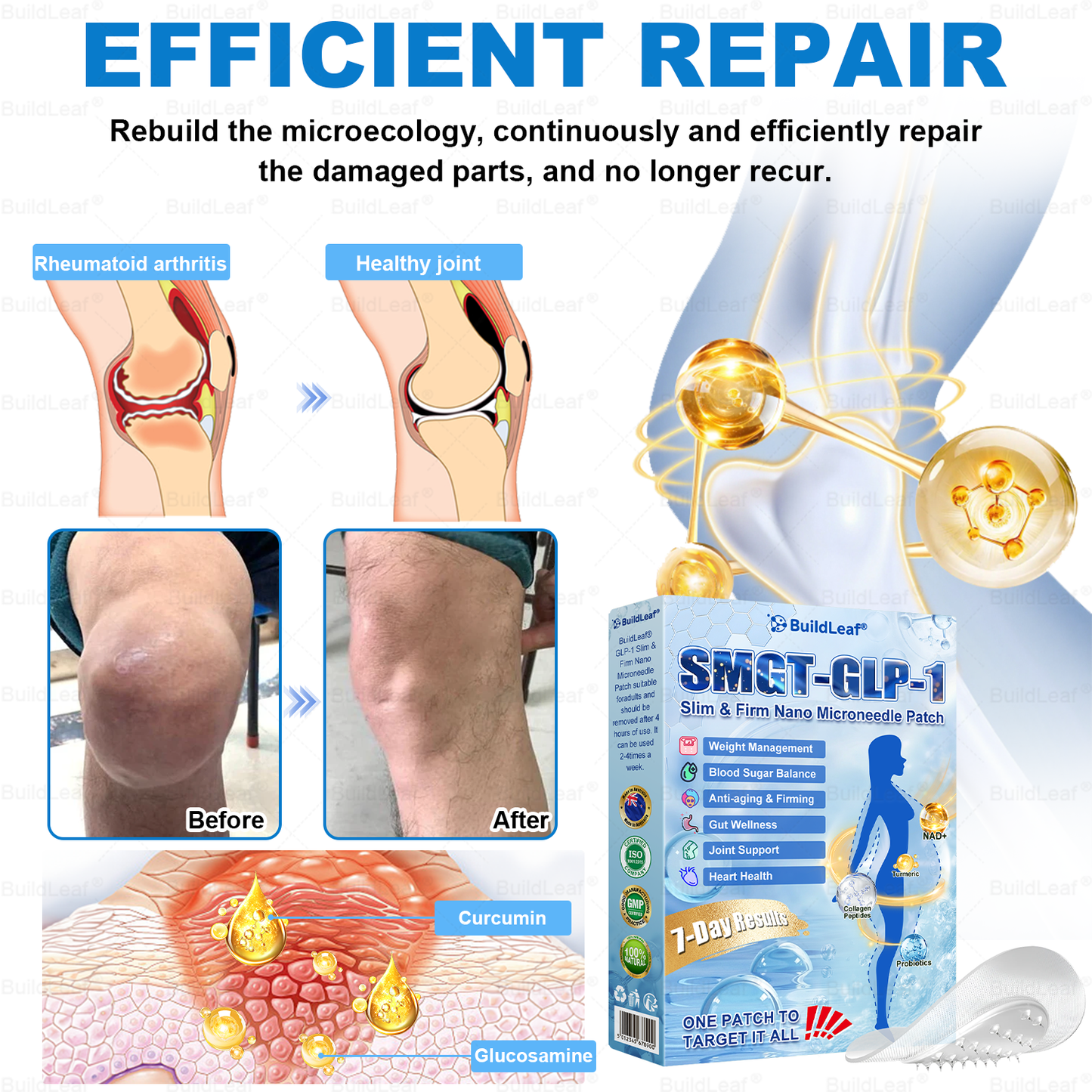 🏥𝑶𝒇𝒇𝒊𝒄𝒊𝒂𝒍 𝑺𝒕𝒐𝒓𝒆 |𝐵uil𝗱𝐿ea𝐟® 𝑮𝐋𝑃-1 Slim & Firm 𝑁ano 𝑀icroneedle 𝑃atch with Collagen,Turmeric&Matrixyl 3000 丨Obesity,Cardiovascular Diseas, Diabetes, Sleep Apnea, Joint Problems and More